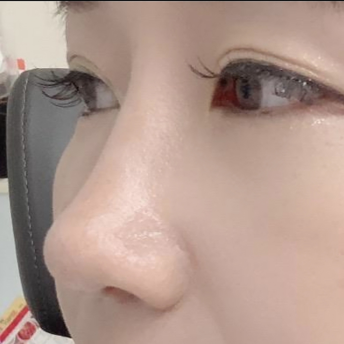 [Mũi] Rebecca123 - Mũi