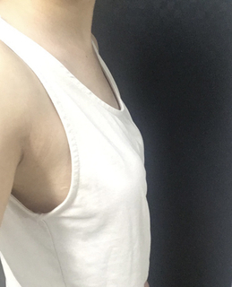 [Ngực] 2 giờ chiều - Ngực