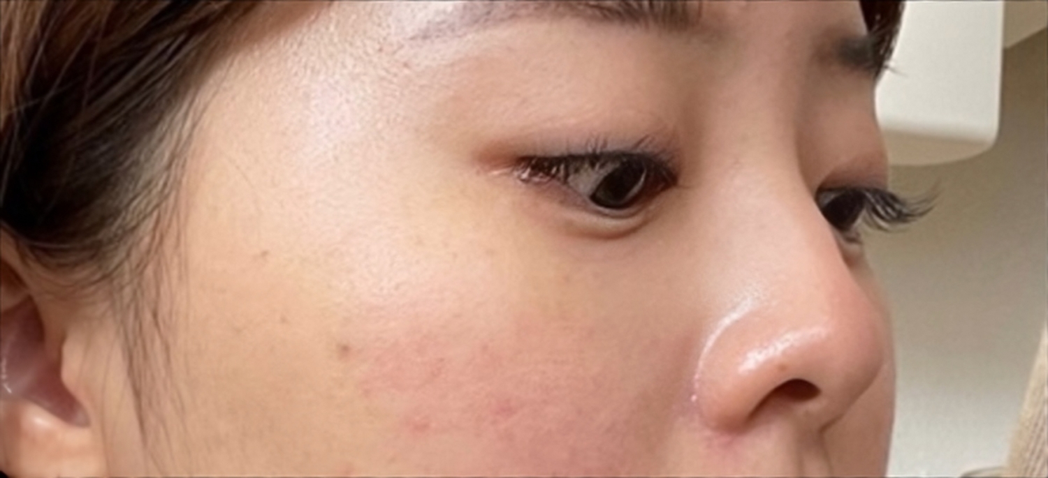 [Mũi] MyangMyang - Mũi