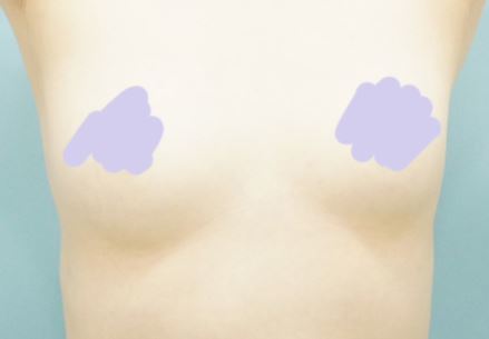 [Ngực] Ocean From The Blue - Ngực