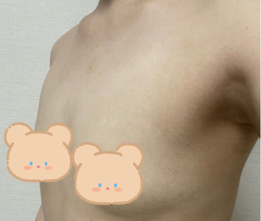 [Ngực] Roulala - Ngực