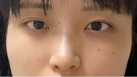 [Mũi] Toughkukik - Mắt, Mũi