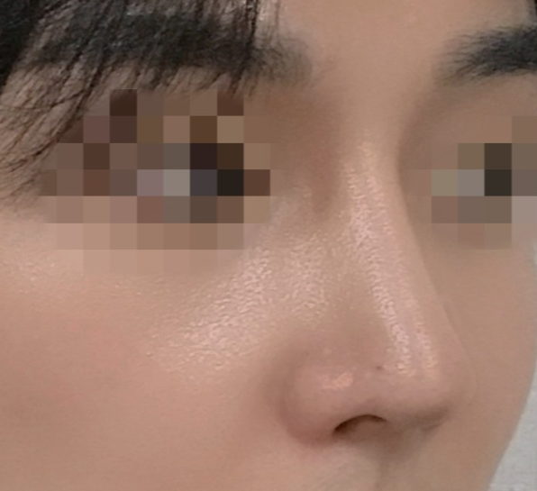 [Mũi] Mình là Kelly - Mũi