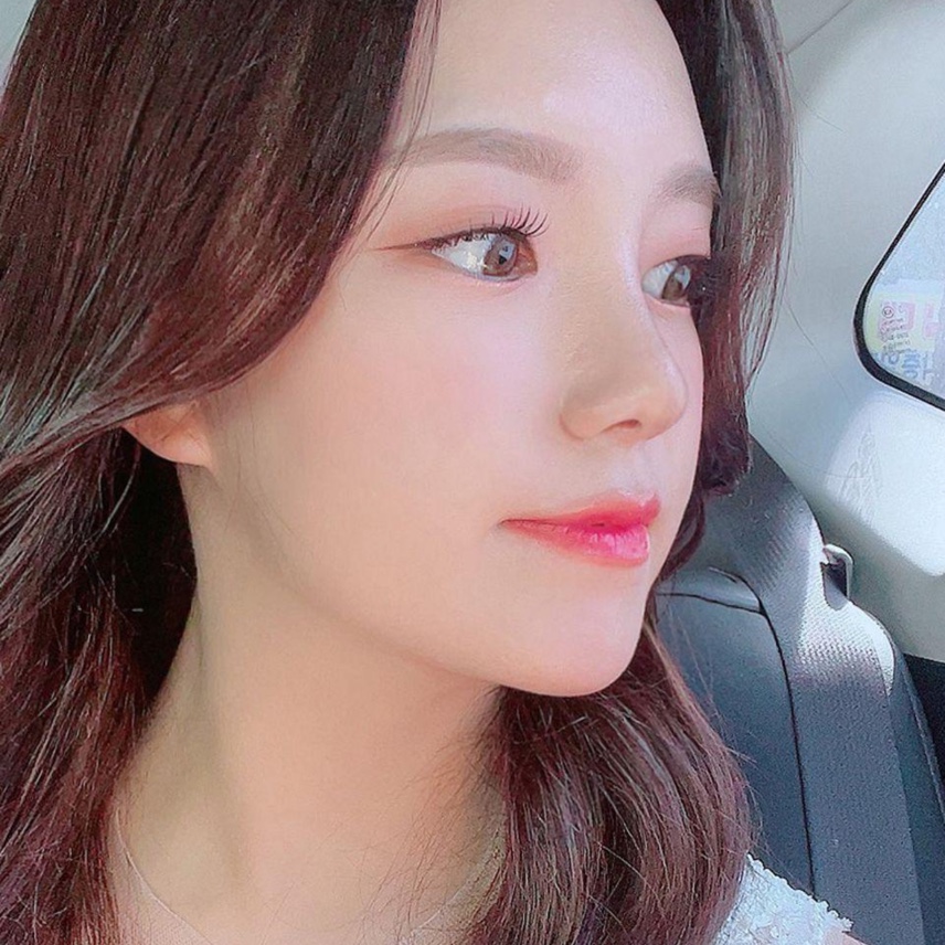 Đã 3 tháng kể từ khi mình phẫu thuật mũi tại Bệnh viện thẩm mỹ Weavers.