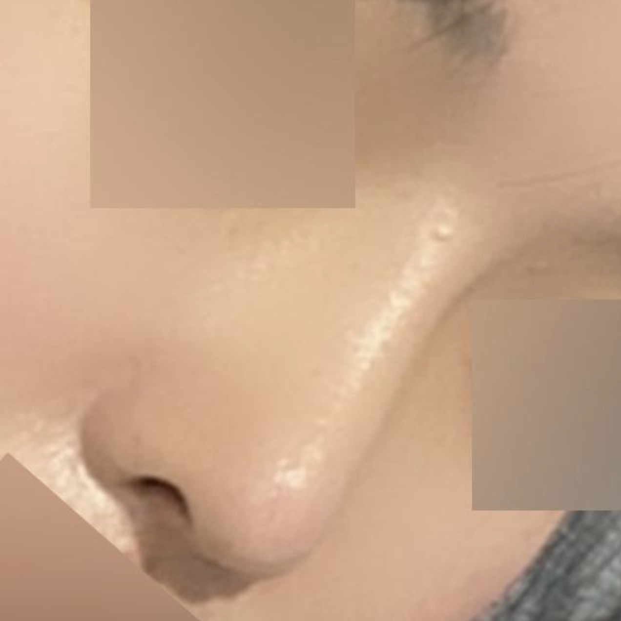 Để lại đánh giá sau khi phẫu thuật thẩm mỹ mũi