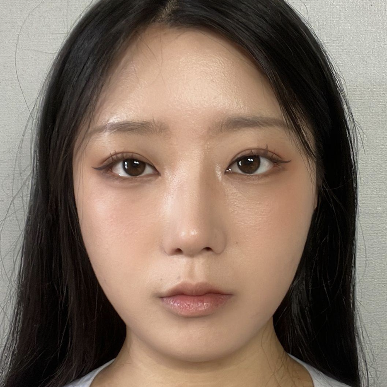 Sau hai tháng, mắt mình trông tự nhiên và đẹp hơn, và vị trí cũng ổn định hơn ~