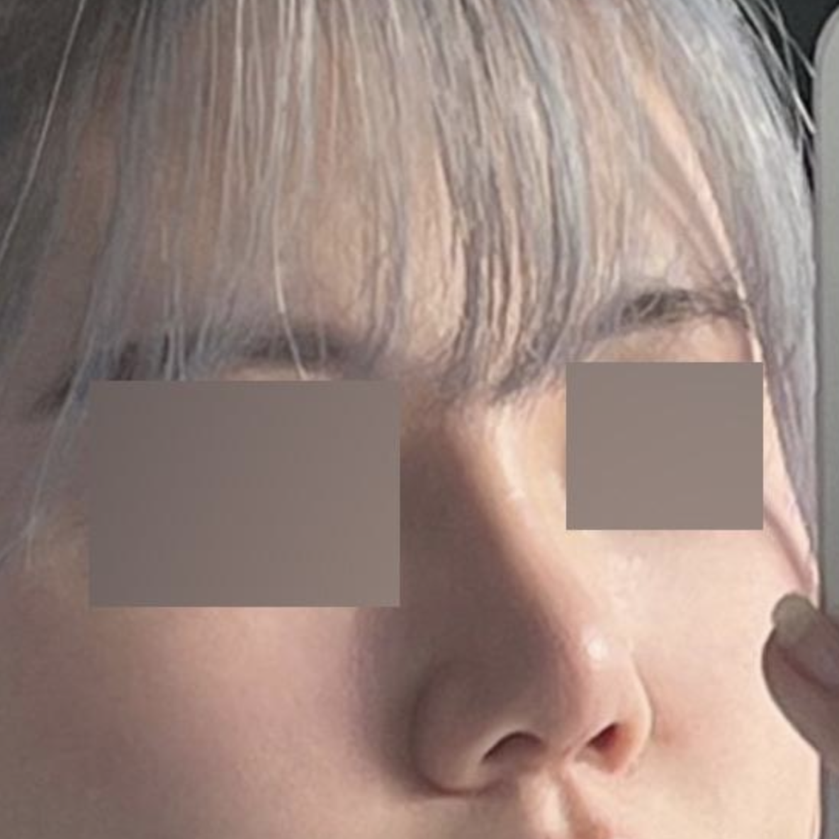 Cảm động vì có chiếc mũi đẹp không cần chỉnh sửa + Cảm ơn bác sĩ viện trưởng rất nhiều!