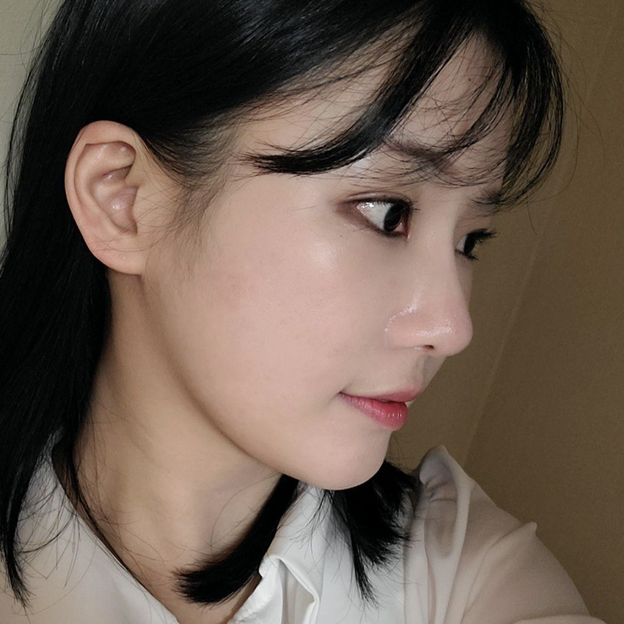 Đã được 2 tháng kể từ khi mình phẫu thuật lại mắt và mũi tại Bệnh viện thẩm mỹ Weavers