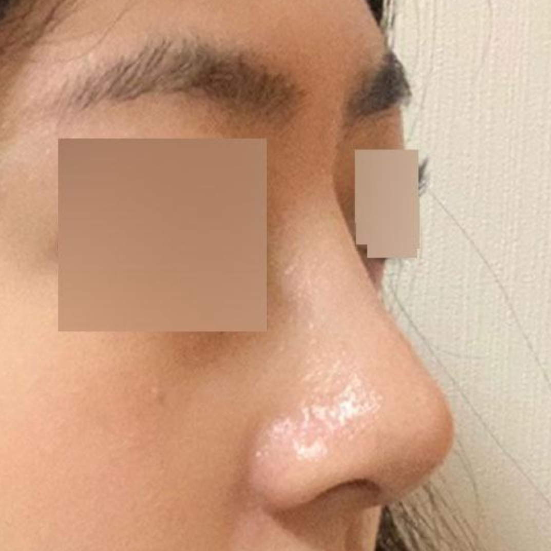 Đánh giá sau một tháng phẫu thuật với bác sĩ Seo Seung-jo.