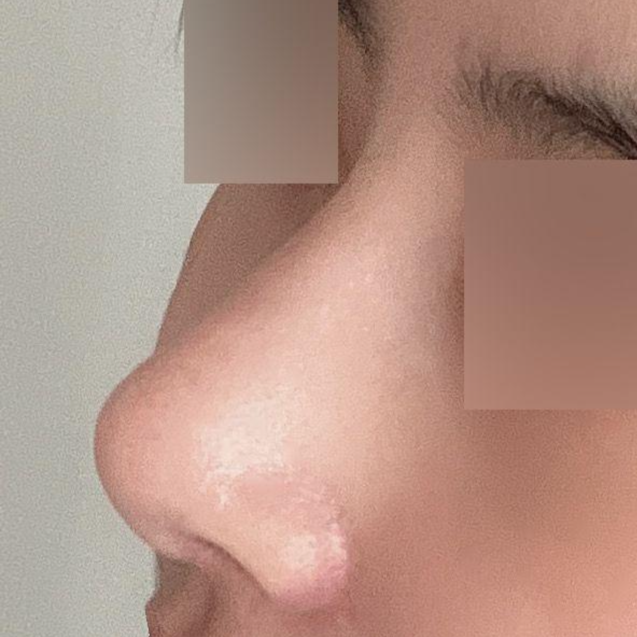 Giờ thì mình nghĩ mình đã hoàn toàn chia tay với chiếc mũi to rồi ㅋㅋ