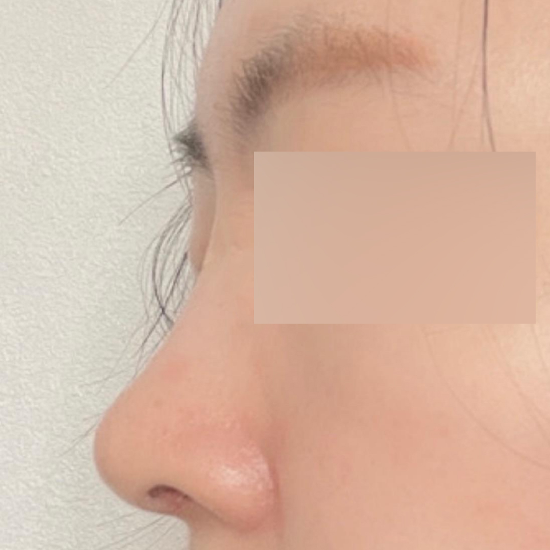 Mình trở nên xinh đẹp hơn rất nhiều nên mình tự tin hơn ngay cả khi không trang điểm