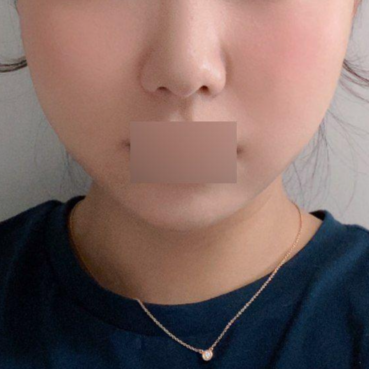 Mình đã căng chỉ với bác sĩ Shim Jung Hwan được 1 tháng rồi