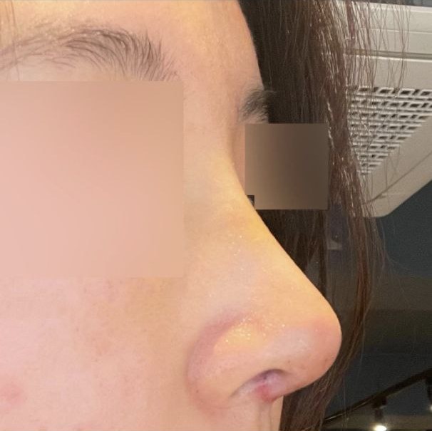 Tư vấn chi tiết mà còn quan tâm đến quá trình hồi phục nữa