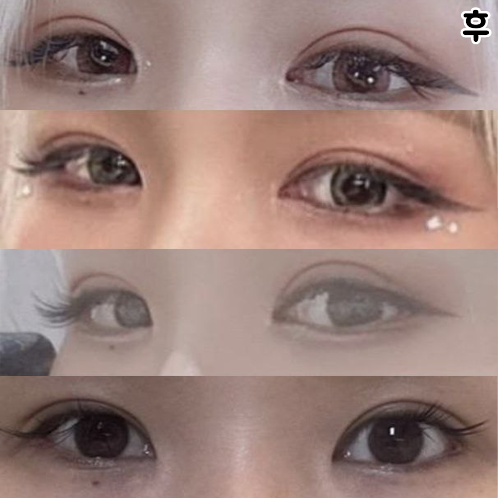 Da của mình đã trở nên đầy đặn hơn khi cười!!!!!!!Vạn tuế vạn tuế!!!!