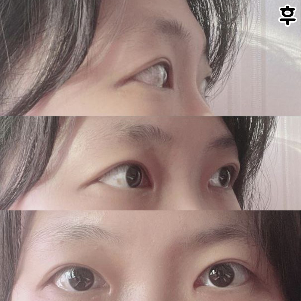 Mình rất thích vì không cần trang điểm đậm khi trang điểm ㅎㅎ