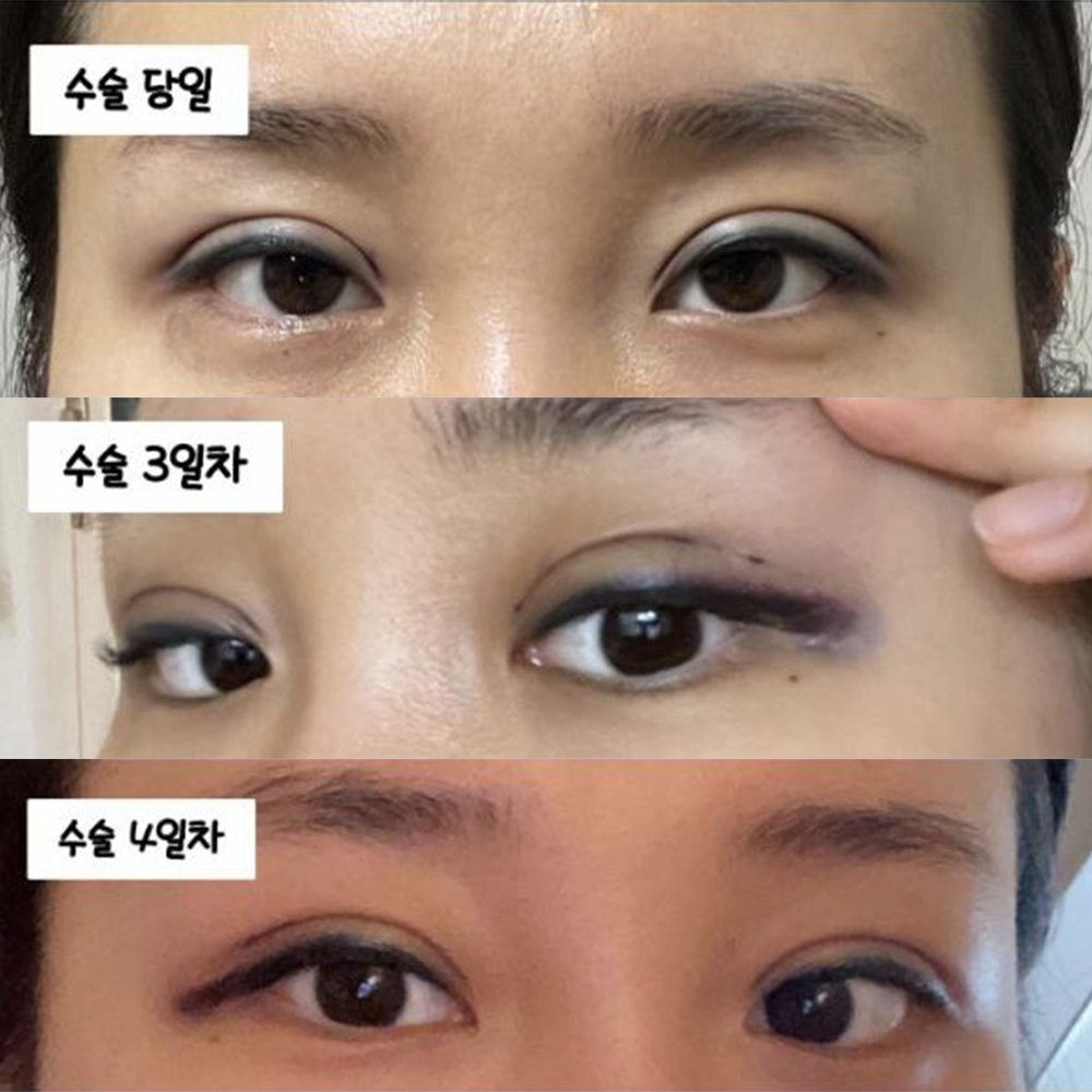 Tư vấn rất tốt, không quá lố, tuyệt vời nhất