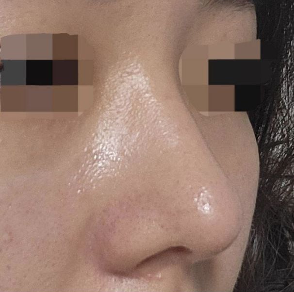 Mình đã rất đắn đo trước khi quyết định thực hiện, nhưng mình không hề thấy tiếc tiền và cảm thấy rất hạnh phúc!