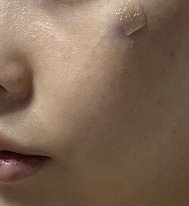 Cảm giác như những phần khiến mình bận tâm đã được cải thiện một cách tự nhiên!