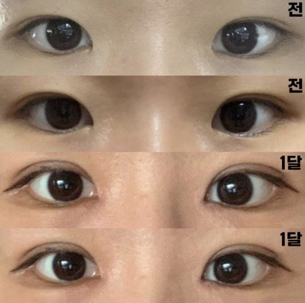 Không giống như những gì mình lo lắng, mình hài lòng vì sự thay đổi hiển hiện rõ ràng!