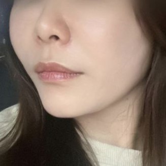 Chỉ nâng cơ mặt Peach mà da mặt mình căng bóng hẳn lên ấy ㅎ