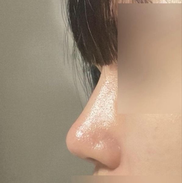 Mọi người nói nếu không nói ra thì sẽ nghĩ đây là mũi của mình ㅋㅋ