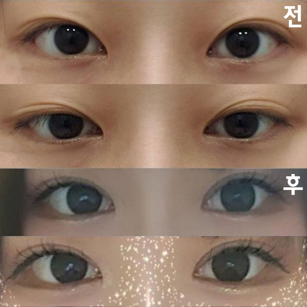 Mình rất hài lòng vì đường nét mí đã được tạo hình gần giống nhau!!