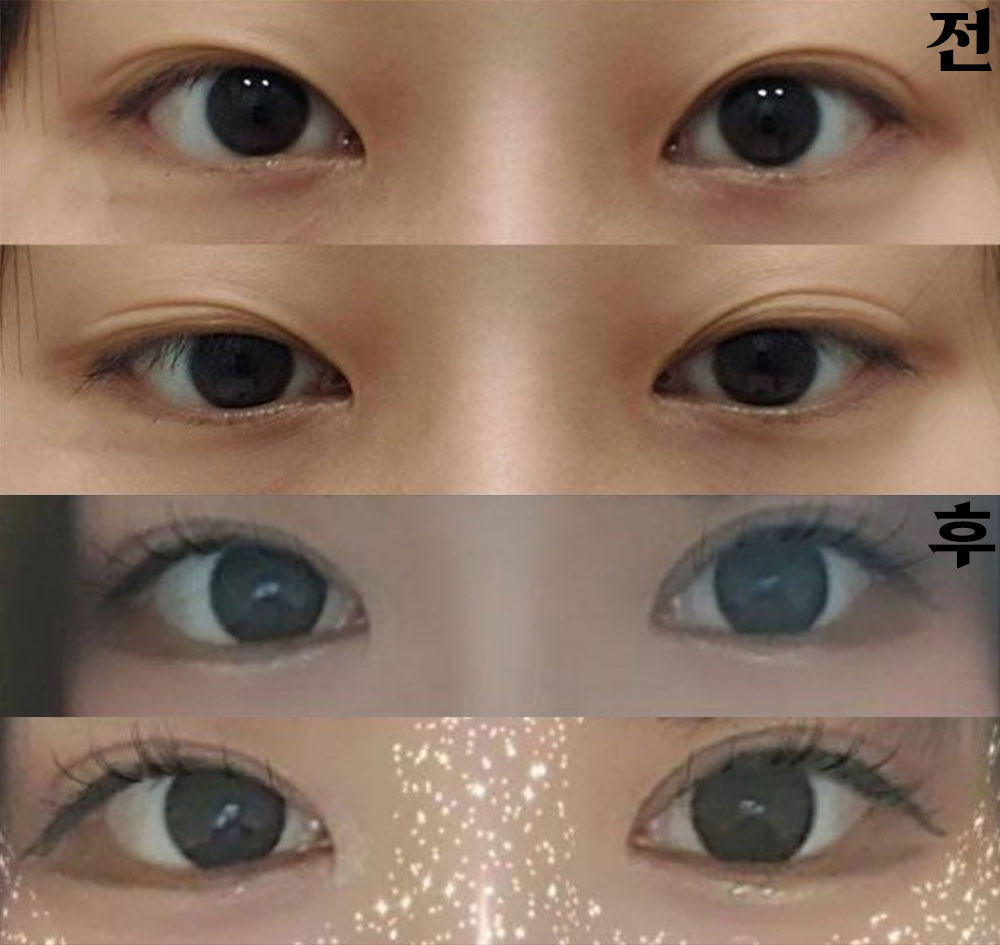 Bác sĩ rất thân thiện nên mình đã quyết định chọn ngay chỗ này!!