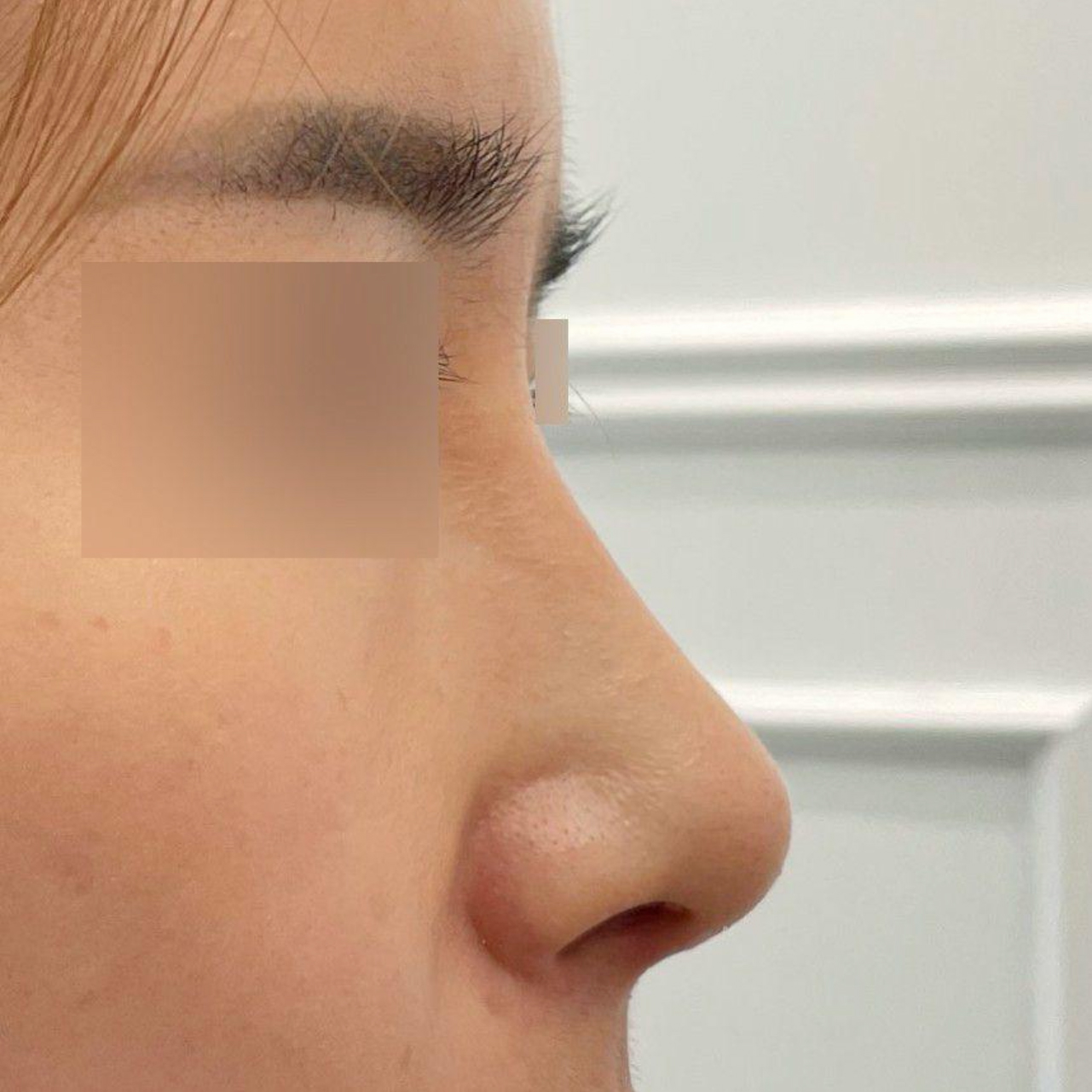 Phẫu thuật rất đẹp ạ ^^